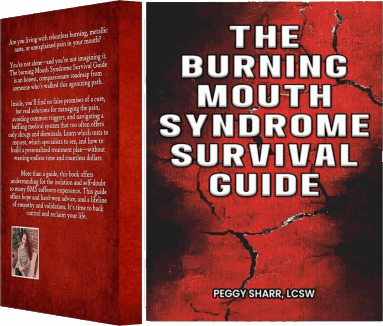 Book cover titled 'The Burning Mouth Syndrome Survival Guide' by Peggy Shar, LCSW.